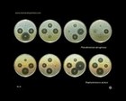 Streptomyces on agar plate